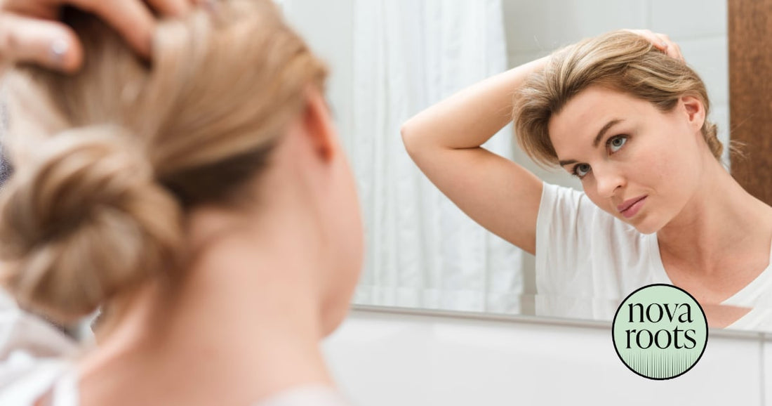 Prečo vám padajú vlasy? Tu sú najčastejšie dôvody (a riešenia)