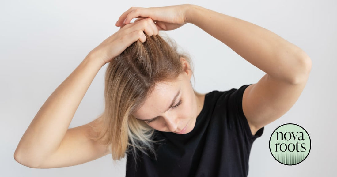 Psoriáza (lupienka) na pokožke hlavy: príznaky a liečba