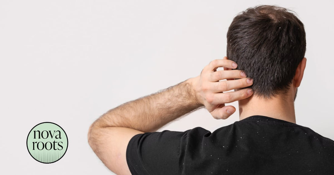 Stop lupinám: Čo skutočne funguje podľa odborníkov