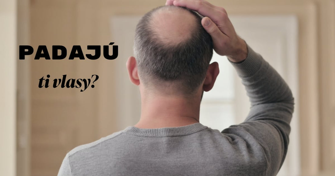 Prečo vám vypadávajú vlasy? 5 častých a skrytých príčin